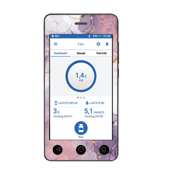 Omnipod dash Pink Marble